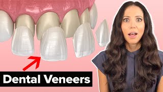 Dental Veneers Procedure Explained [upl. by Anneis]