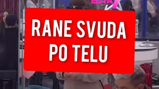 RANE SVUDA PO TELU  UZAS U ZADRUZI JAVILI UPRAVO [upl. by Serolod9]