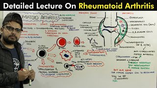 Rheumatoid Arthritis Pathophysiology of Arthritis [upl. by Fenelia739]