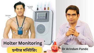 হল্টার মনিটরিং I Holter Monitoring Different types When needed What it detects  Dr Arindam Pande [upl. by Harrie125]