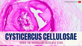 Cysticercus cellulosae under the microscope with Haematoxylin and Eosin HampE stain [upl. by Seow254]