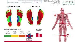 Custom orthotics footlevelers scan feet arches [upl. by Ayekam]