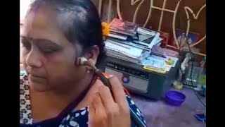 Facial palsy or Bells palsy best physiotherapy treatment speech in bengali [upl. by Brunell576]