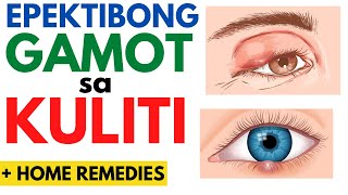 👀 GAMOT sa KULITI  Paano gumaling ang KULITI o BUTLIG sa MATA  Home Remedies Sintomas  Eye Sty [upl. by Omrellig]