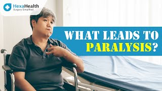 Know all about Paralysis  HexaHealth Expert Dr Sanjay Kumar Chaudhary [upl. by Uokes]