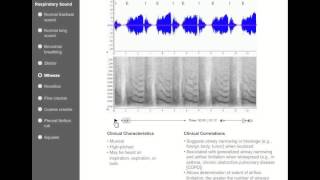 Chest Auscultation  Clinical Examination [upl. by Olwen]