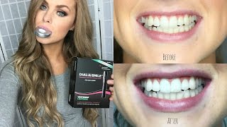 ♡How to Whiten Your Teeth at Home Gerard Cosmetics DialASmile Kit♡ [upl. by Northington]