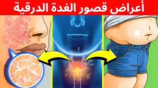 10 علامات واضحة تدل على أن لديك انخفاض حاد في مستوىات الغدة الدرقية [upl. by Damle]