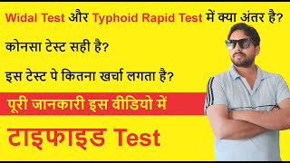 TyphiDot Test IgM amp IgG Antibody  TyphiDot Test Report Reading  Typhoid Blood Test [upl. by Quin]