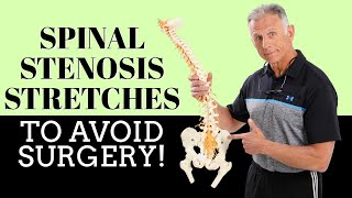 Best 3 Stretches To Quickly Remedy Lumbar Spinal Stenosis amp Avoid Surgery [upl. by Ahsiki]