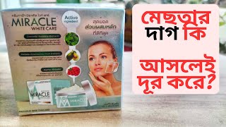 Miracle White Care Cream Review । মেছতা ও ব্রনের দাগ দূর করতে কেমন কার্যকরি [upl. by Aiderfla340]