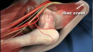 Hip Anatomy  Anterior Approach to Hip Replacement [upl. by Pyle158]