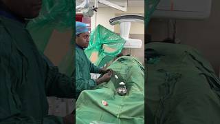 देखिए कैसे होता है वैरिकोसेल का इलाज  Live Varicocele Embolization shortsfeed2024 livesurgeryroom [upl. by Esac]