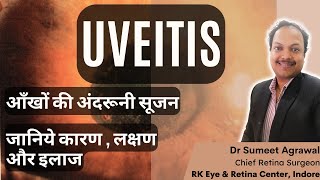 UVEITIS यानी आँखों की अंदरूनी सूजन जानिये इसके बारे में सब कुछ [upl. by Kip282]