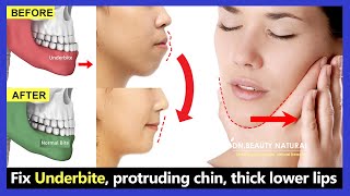 5 Exercises Fix Underbite without surgery fix protruding chin reduce thick lower lip [upl. by Cchaddie]