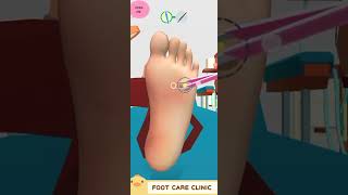 ASMR Surgery to remove large planter warts animation  Corn Foot callus asmrshortssatisfyingfoot [upl. by Anelah135]