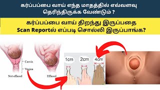 cervical effacement in tamil  cervix dilation chart in tamil  cervix dilation symptoms in tamil [upl. by Suillenroc]