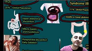 Functional Dyspepsia FD vs Irritable Bowel Disease IBS [upl. by Bottali]