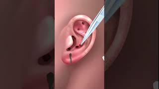 Cleaning Your Ears An ASMR Experience  asmr satisfiedasmr earcleaningasmr [upl. by Heffron]