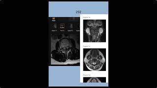 RADIOLOGY EXAM CASES [upl. by Sydney260]