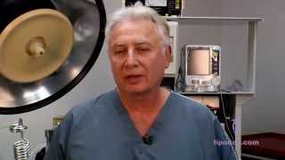 Laser Liposuction Dr Leon Forrester Tcheupdjian MD [upl. by Odel]