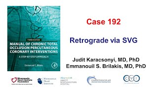 Case 192 Manual of CTO PCI  Retrograde via SVG [upl. by Benetta]