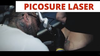 PicoSure Laser Tattoo Removal ETLASER Удаление тату №1 в Москве Виктор Галушин [upl. by Heron930]