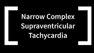 Narrow Complex Supraventricular Tachycardia [upl. by Assiralk360]