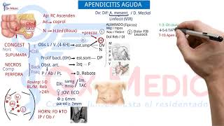 Ficha resumen Cirugía general Apendicitis aguda ENAMENARMSERUMS [upl. by Drhacir]