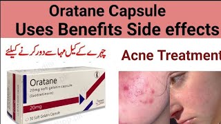 oratane capsule uses in Urdu hindi l Isotretinoin use side effects [upl. by Oakman105]