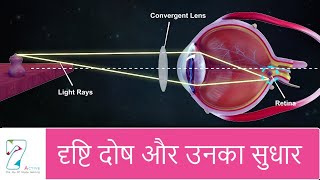 दृष्टि दोष और उनका सुधार  Defects of Vision and their correction  Hindi [upl. by Donald615]