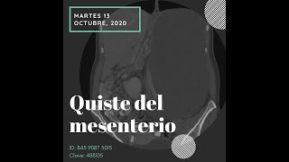 Quiste del Mesenterio [upl. by Kerred]