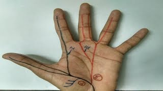 Median Nerve  3  Branches in Hand APB FPB OP Lumbricals 1 and 2 [upl. by Ahsilet]