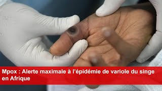 Mpox  Alerte maximale à l’épidémie de variole du singe en Afrique [upl. by Eilrebma277]