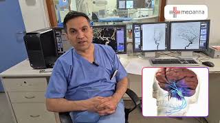 What is Digital Subtraction Angiography DSA Test [upl. by Rephotsirhc]