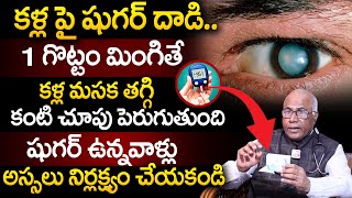 కళ్ల పై షుగర్ దాడి  Reduces Diabetic Retina Problems  DMacula  Dr CL Venkat Rao  PlayEven [upl. by Mable]