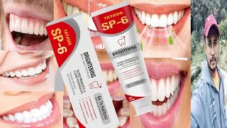 Yayashi Sp6 Toothpaste  Honest Review [upl. by Aerdnas]