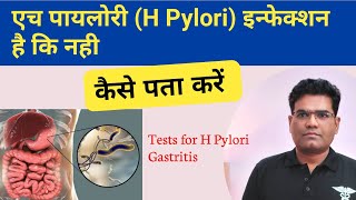 H Pylori Infection की जांच कैसे होती है  Tests for H Pylori Gastritis [upl. by Okimik927]