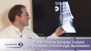 Stellungskorrektur Osteotomie des Sprunggelenks [upl. by Nylia805]