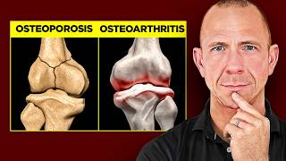 How to Prevent and Treat Osteoporosis vs Osteoarthritis full guide [upl. by Nyloj]