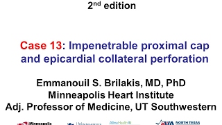 Case 13 Manual of CTO Interventions  Epicardial collateral perforation [upl. by Ykcaj]