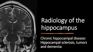 Radiology of the hippocampus  chronic hippocampal disease [upl. by Nomaj37]