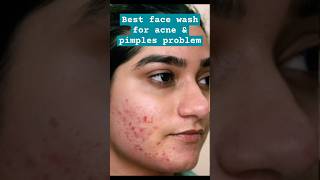 Best face wash for acne and pimples problem  acne skincare routine shorts ytshort skincare skin [upl. by Theola]