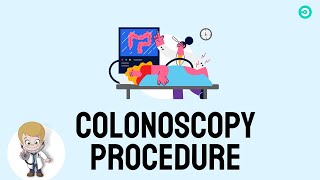 colonoscopy procedure explained [upl. by Devland]