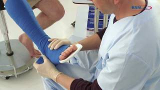 Synthetic splinting reinforced posterior leg splintENby BSN medical [upl. by Adnolrehs]