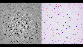 Cells flowing in a microfluidic cell culture device for studying immune cell behavior [upl. by Grogan]