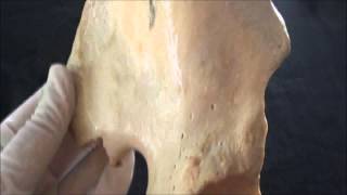 Hip bone anatomy  Part 2  The Ilium [upl. by Maryl]