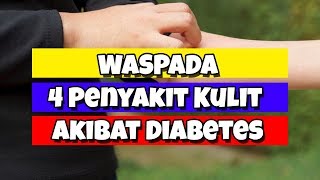 4 Penyakit Kulit Gatal Gatal yang diakibatkan Gula darah tinggi Diabetes DoctorAW 01 [upl. by Gwennie]