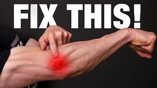 How to Fix Tennis Elbow PERMANENTLY [upl. by Nnyladnarb]