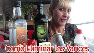 Como Eliminar las Varices De Forma Natural [upl. by Olympia]